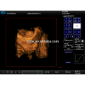 DW-C900 4D doppler couleur machine à ultrasons avec fonction élastographie